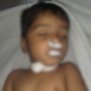 Bhopal Child Mishap Death